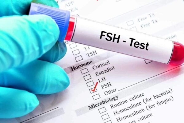 FSH Test