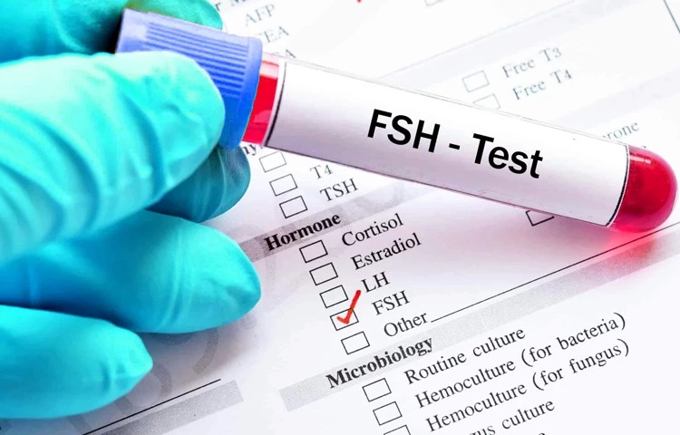 FSH Test