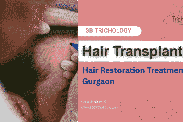 Why Is Hair Transplant An Amazing Hair Restoration Procedure? Hair Transplant Hair Restoration