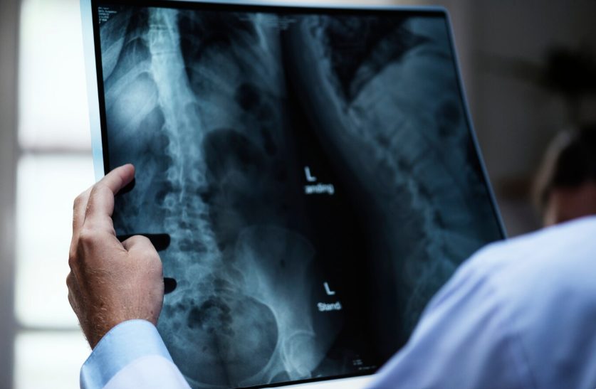 x ray cost in dubai