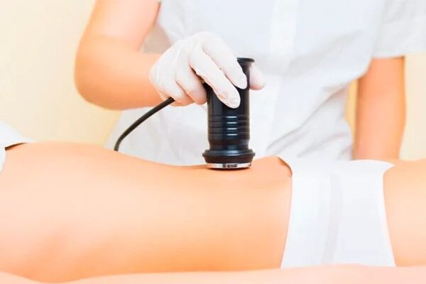 What Is Cryoskin Treatment