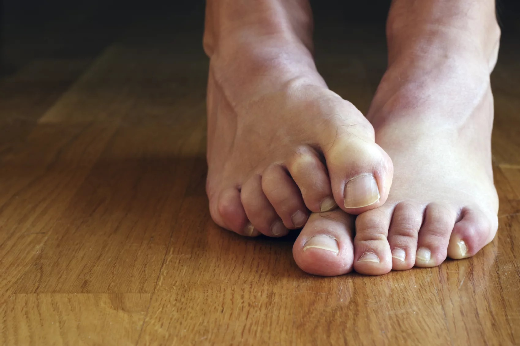 Why Expert Podiatry Matters for Long-Term Foot Health in Edinburgh