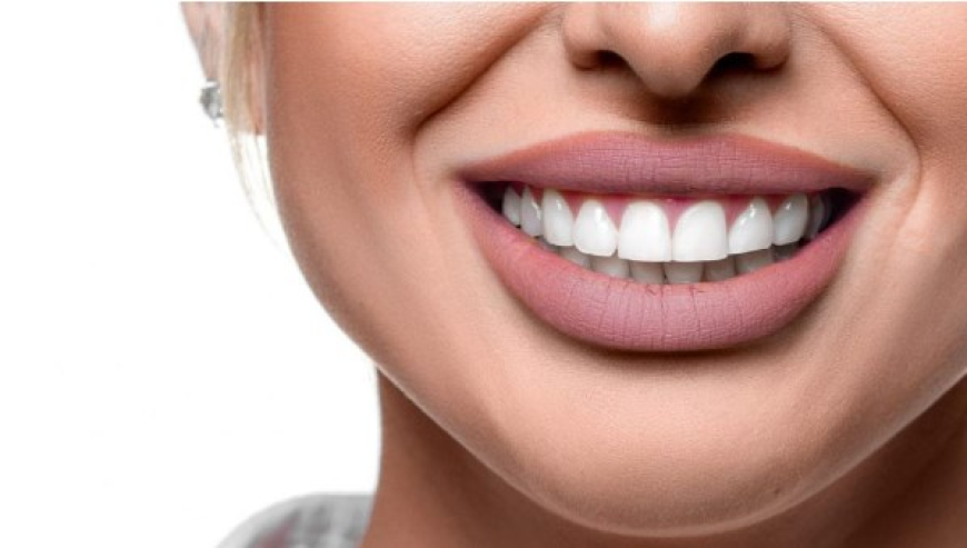 Italian Dental Clinic Dubai