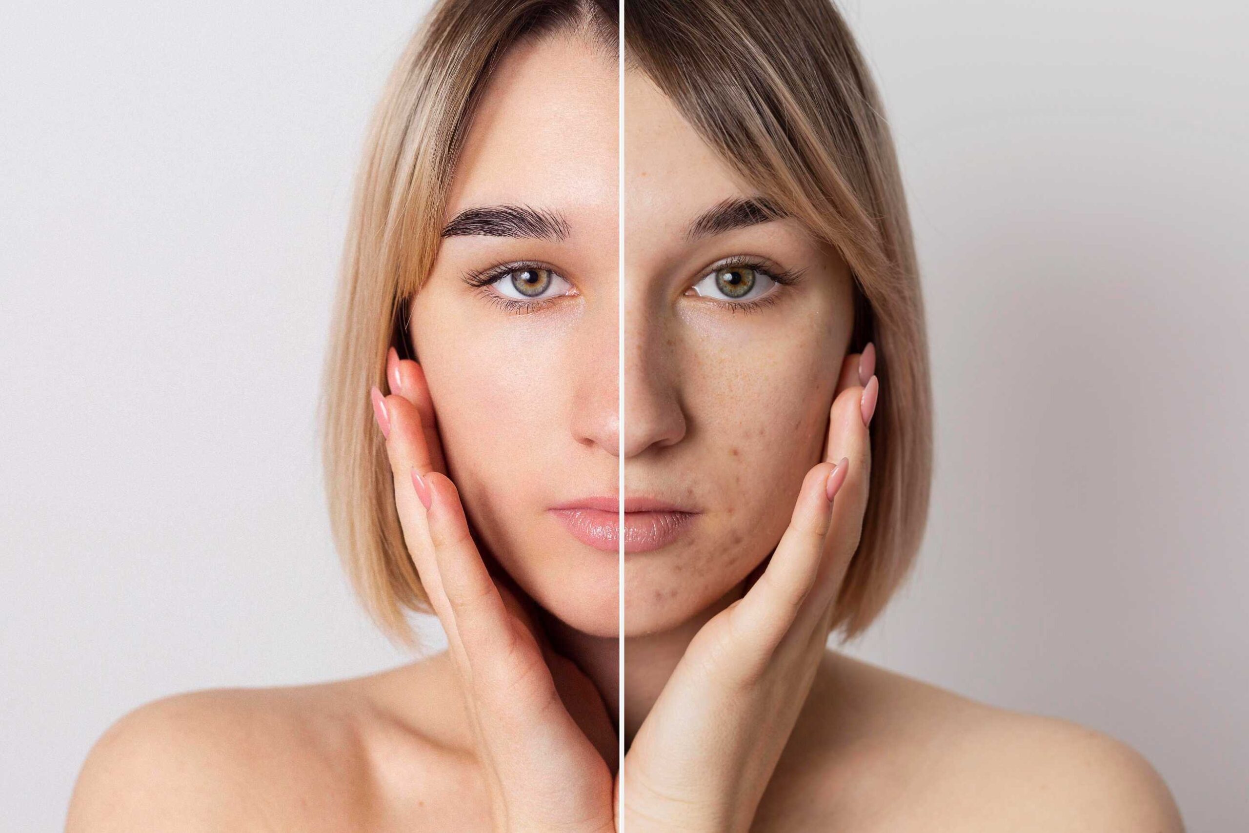 skin pigmentation treatment
