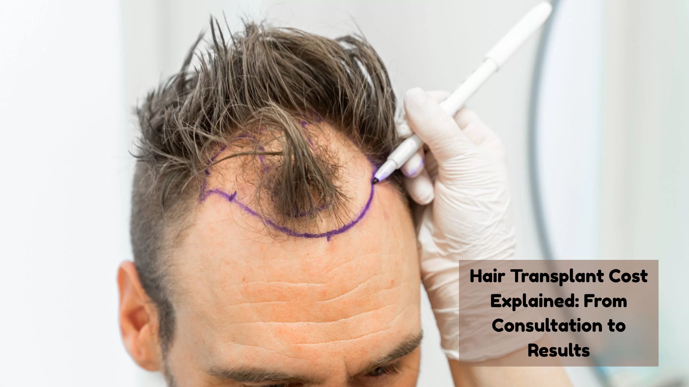 hair transplant cost
