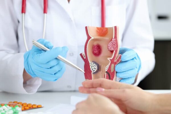 Relief You Can Trust: Where to Find Compassionate Hemorrhoid Care in Chicago hemorrhoid treatment center chicago