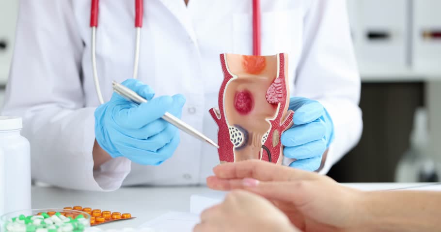 hemorrhoid treatment center chicago