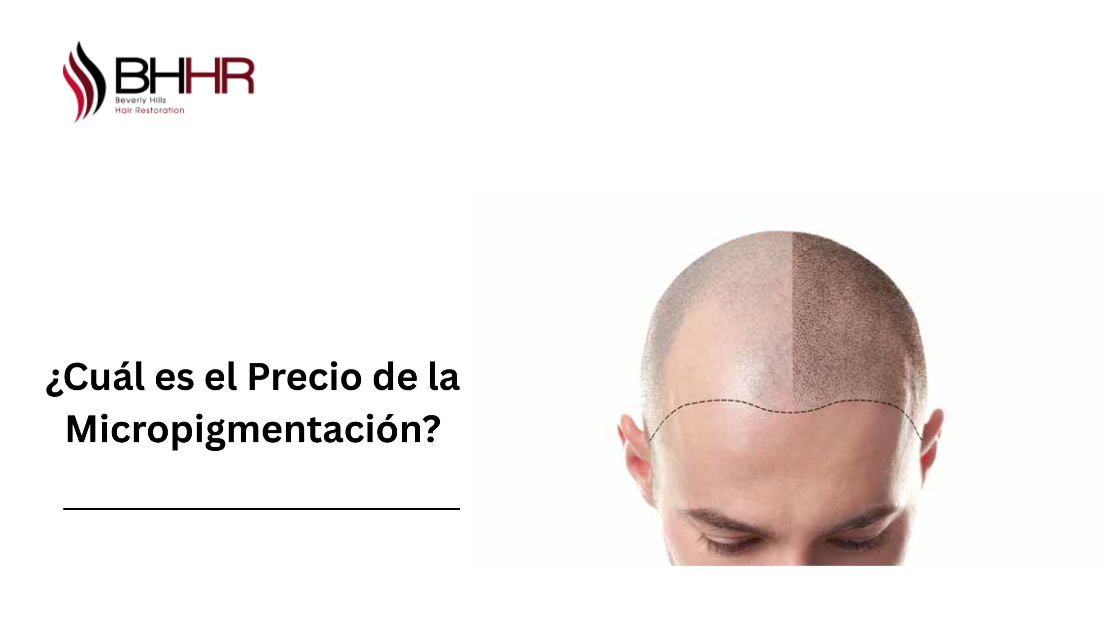 ¿Cuál es el Precio de la Micropigmentación?
