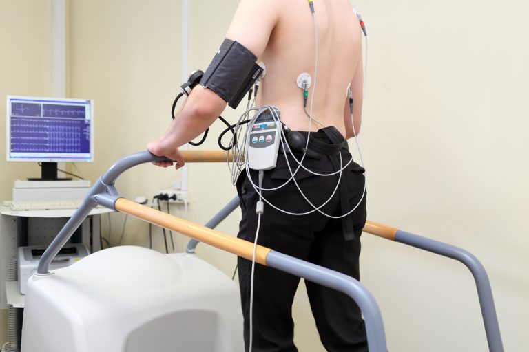 treadmill test cost in bangalore