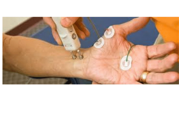 ncv nerve test in bangalore