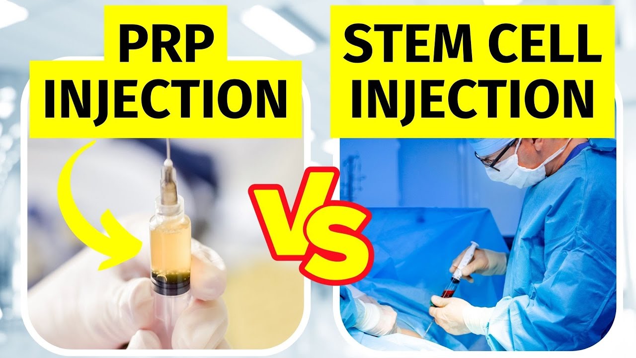 PRP vs Stem Cell Therapy